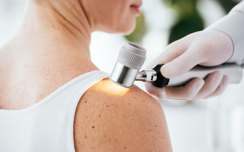 signs of non-melanoma skin cancer
