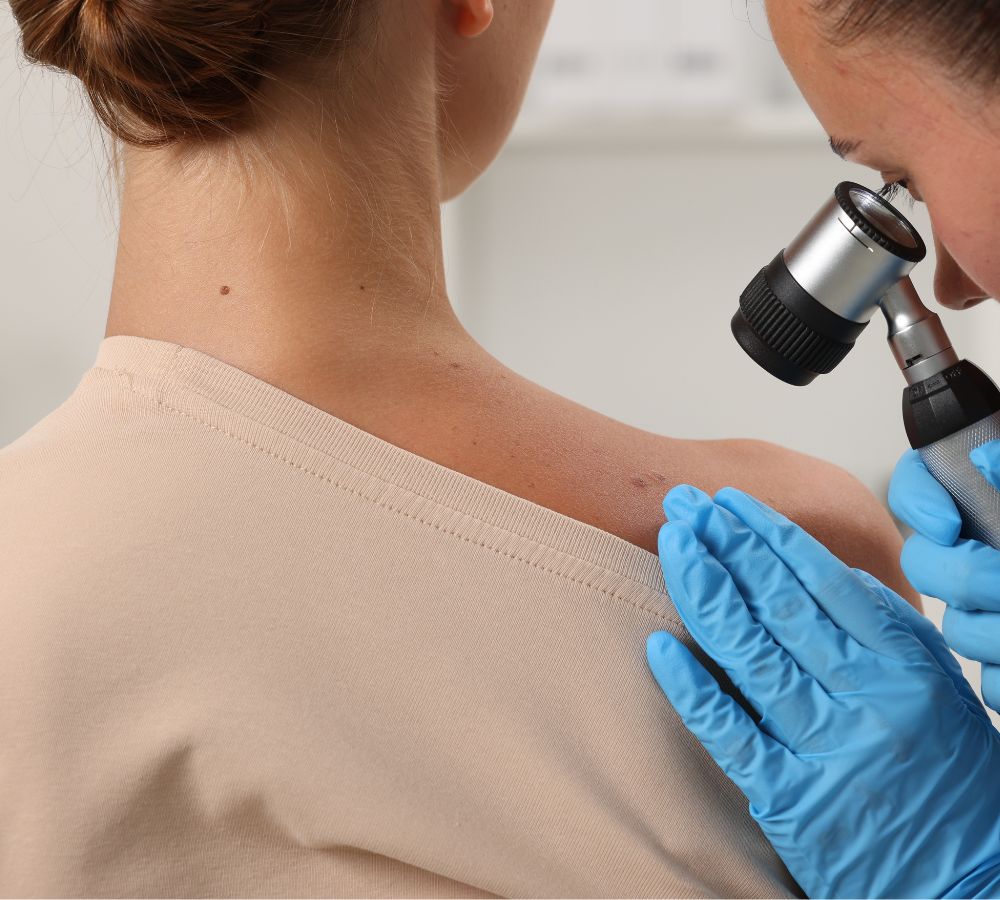 Dermatology at GP London W1